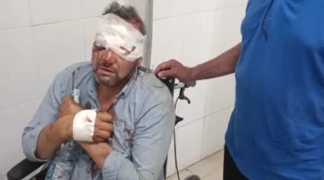 إصابة معلمين في حادث انقلاب دراجة نارية أثناء التوجه لمراقبة امتحانات الإعدادية